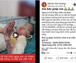 Người bệnh mang tiếng oan vì có kênh chạy quảng cáo kêu gọi từ thiện vào tài khoản lạ