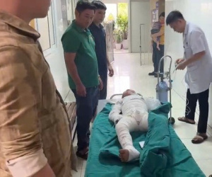Nghe tiếng khóc, mẹ chạy về bàng hoàng thấy con như 'ngọn đuốc sống'