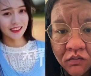 Biến đổi 'sốc' trên khuôn mặt mẹ trẻ khi mang thai: Từ 'rạng rỡ' bất ngờ đến khó nhận ra chính mình trong gương