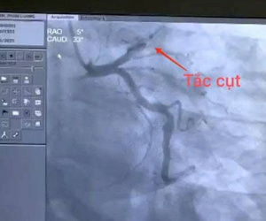 Bỏ qua thủ tục tài chính, bật báo động đỏ cứu người nguy kịch trên đường đi làm