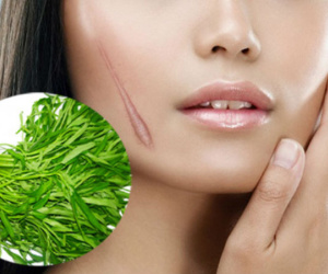 Thực hư chuyện ăn rau muống gây sẹo lồi