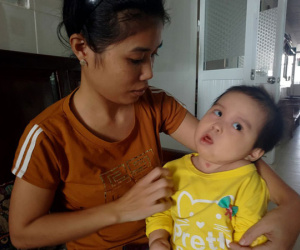 Xót thương bé gái hơn 1 tuổi bị côn trùng đốt khiến tay chân co quắp, teo não không thể nhận thức
