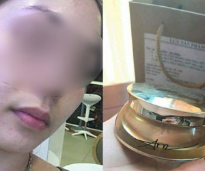 Khách hàng từng là đại lý của TS Group tố bị mẩn ngứa khi dùng sản phẩm: "Bây giờ liên hệ với họ như đi mò kim đáy bể"