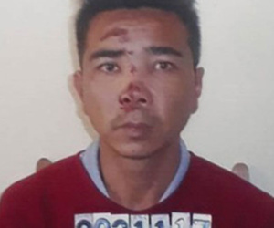 Thanh Hóa: Ghen tuông, đâm trọng thương người tình bằng dao