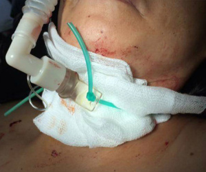 Vụ bà chủ tiệm tóc bị cắt cổ: Gây án xong, nghi phạm bình thản đi nghe ngóng
