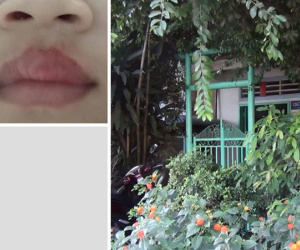 Đình chỉ nhà trẻ tư thục nơi bảo mẫu 'bạo hành trẻ' bằng ớt