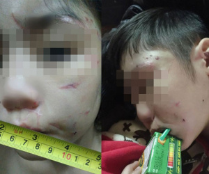 Bác sĩ tâm lý 'mổ xẻ' vụ bố, mẹ kế bạo hành bé trai 10 tuổi