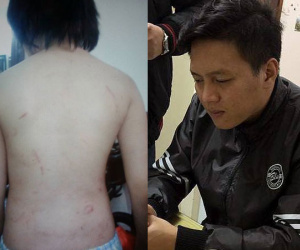 Vụ bé trai 10 tuổi bị bạo hành dã man: Mẹ kế thừa nhận bạo hành con chồng vì cháu ăn vụng thịt bò