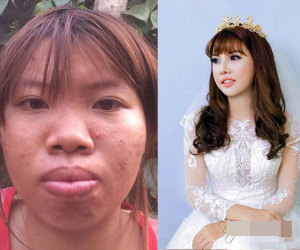 “Thị Nở tái sinh” sắp tái hôn với trai tân 28 tuổi