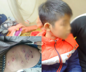 Chủ tịch thành phố Hà Nội yêu cầu làm rõ vụ bé trai 9 tuổi bị bố đẻ dùng dây điện đánh đập dã man