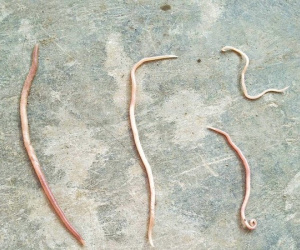 Hãi hùng giun sán dài nửa mét bò ra từ... miệng các em nhỏ