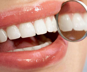 Tiết lộ 5 vấn đề sức khỏe qua răng miệng