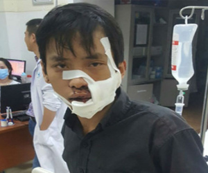 Chém nhau kinh hoàng trên phố, 5 người nhập viện