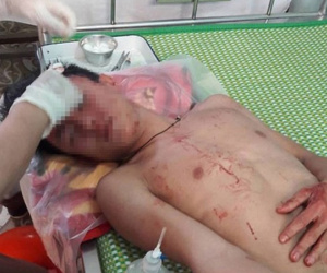 Nghệ An: Nhóm thanh niên vào trường hành hung thầy giáo và học sinh