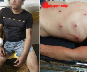 Bị truy đuổi, 'cẩu tặc' rút súng bắn 2 người dân nhập viện