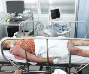 Nghi 'ma nhập' hai chị em bị thầy pháp dùng doi dâu đánh thâm tím toàn thân, khiến nguy kịch