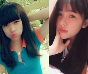 Bốn lần phẫu thuật thẩm mỹ giúp cô gái xấu xí hóa xinh đẹp