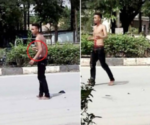 Nam thanh niên nghi 'ngáo đá' tự đâm xổ ruột giữa đường