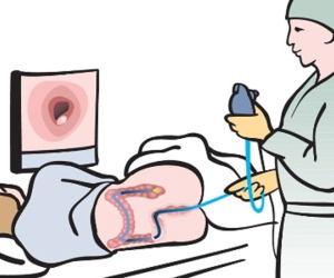 Hai xét nghiệm giúp loại bỏ sớm tế bào ung thư