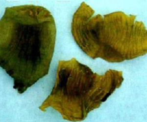 Màng mề gà trị bệnh đường tiêu hóa
