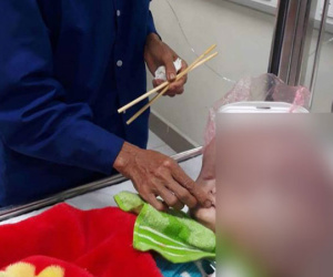 Bé trai 13 tháng tuổi chịu đau đớn từng ngày vì đầu to, mặt 'không giống ai'
