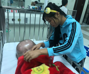 Video: Tâm sự của mẹ bé trai có đầu to như quả bóng