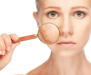 5 loại sản phẩm làm đẹp mà các quý cô da nhạy cảm có chết cũng đừng nên sử dụng