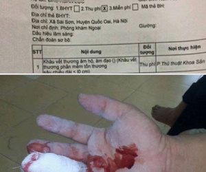 Bi hài nam bệnh nhân bị rách tay được chỉ định khâu... 'cô bé'