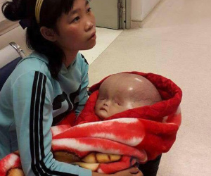 Người mẹ bị tố không đồng ý đưa con bị não úng thủy sang Singapore chữa trị lên tiếng
