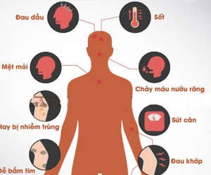10 dấu hiệu ung thư máu mọi người cần cảnh giác