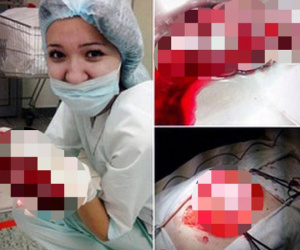 Nữ y tá Nga chơi đùa với nội tạng bệnh nhân gây phẫn nộ