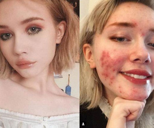 Mệt mỏi vì 'sống ảo', hot girl 17 tuổi lộ mặt thật khiến dân tình sốc nặng