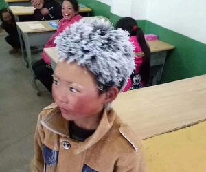 Cậu bé TQ bị đóng băng toàn bộ tóc vì trời giá rét