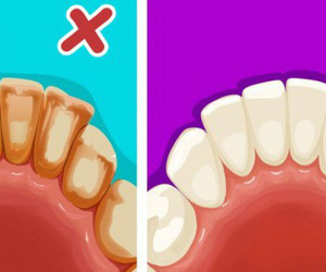 Ghi nhớ 6 mẹo đơn giản để có một hàm răng trắng như sứ