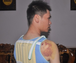Bí thư xã mâu thuẫn ngoài xã hội, con trai đến bắn người nhập viện
