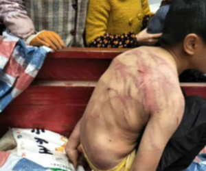 Bị bố mẹ đánh, bé trai cởi trần ngủ suốt đêm ngoài trời âm 2 độ