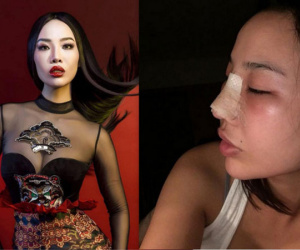 Sau ồn ào với Kim Lý, Kiko Chan nói gì khi bị 'phanh phui' đã lấy chồng và phẫu thuật thẩm mỹ?