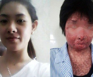 Cuộc sống tươi mới của người phụ nữ xinh đẹp bị chồng tẩm xăng đốt