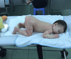 Mẹ tưởng con chỉ bị viêm phổi nhưng cuối cùng lại mắc bệnh lạ nguy hiểm