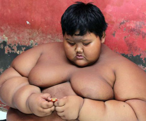 Cậu bé béo nhất thế giới giảm được 76 kg