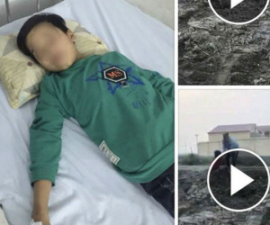 Thực hư sự việc bé trai ăn trộm ngô bị đánh chấn thương sọ não