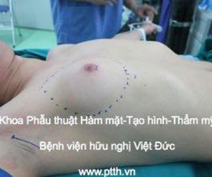 Chàng trai trẻ khổ sở với bộ ngực đầy đặn như nữ giới