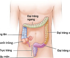 5 dấu hiệu báo động bạn bị ung thư đại trực tràng