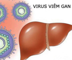 5 dấu hiệu cảnh báo viêm gan B biến thành ung thư gan bạn cần biết càng sớm càng tốt