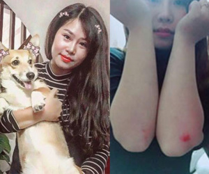 Cô gái liều mình cứu chó khiến dân mạng cảm động: 'Bọn trộm chó không xong với tôi đâu!'