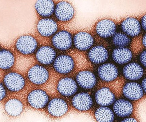 Virus nguy hiểm gây tử vong hàng đầu ở Việt Nam