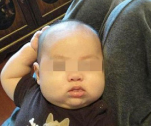 Con liên tục đưa tay lên gãi đầu, bố mẹ cho rằng đó là cử chỉ hết sức bình thường nhưng rồi nhận ra sự thật đáng sợ