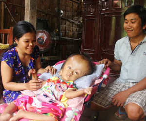 Phép màu kỳ diệu đến với cặp vợ chồng trẻ nuôi con gái 4 tuổi bị não úng thủy, đầu to gấp 3 lần trong năm mới