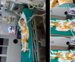 Thái Bình: Chập điện cháy nhà giữa đêm, vợ chồng bỏng nặng, bé gái 4 tuổi nguy kịch