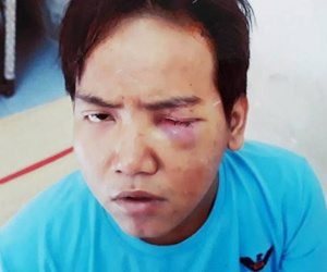 Bảo vệ dân phố sát hại bé trai 6 tuổi ở Sài Gòn bị tâm thần phân liệt